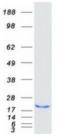 SDS-PAGE (PPIA-001H).jpg